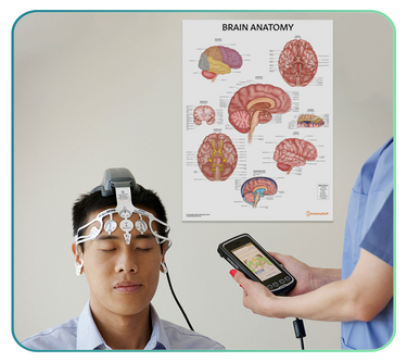 Brain Anatomy Posters