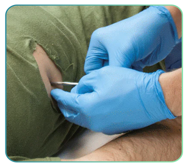 Chest Tube / Drain Training Models