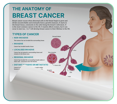 Medical Condition Posters