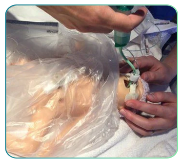 Nasogastric Tube Trainers