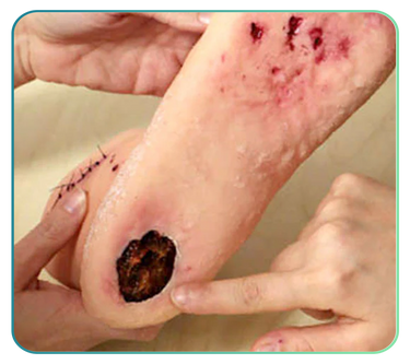 Podiatry Training Models