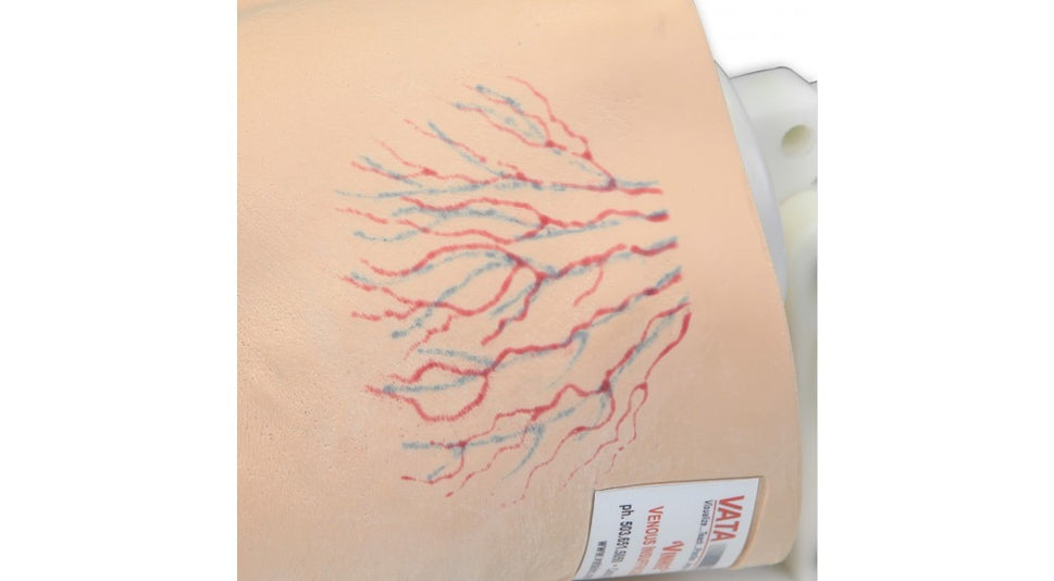 Vinnie Venous Insufficiency Leg