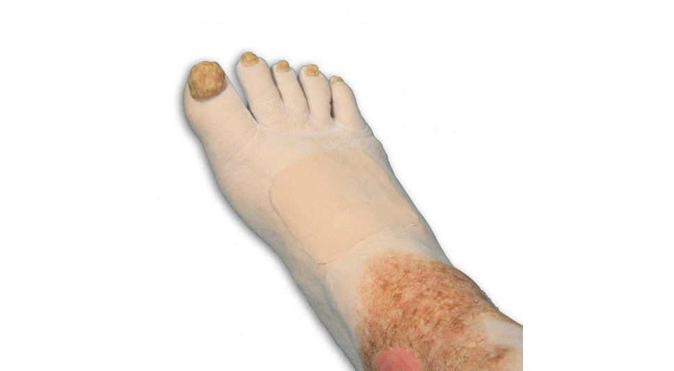 Vinnie Venous Insufficiency Leg