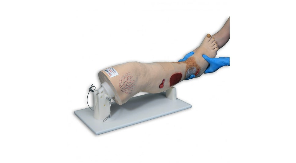 Vinnie Venous Insufficiency Leg