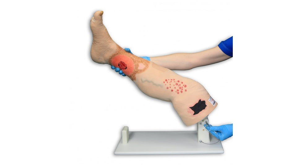 Vinnie Venous Insufficiency Leg