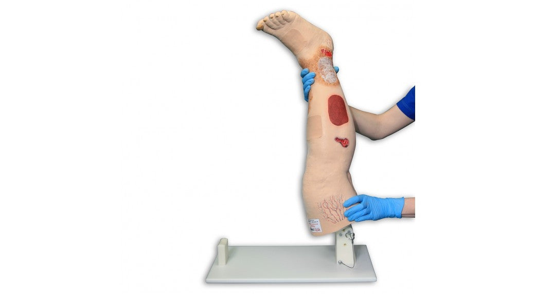 Vinnie Venous Insufficiency Leg