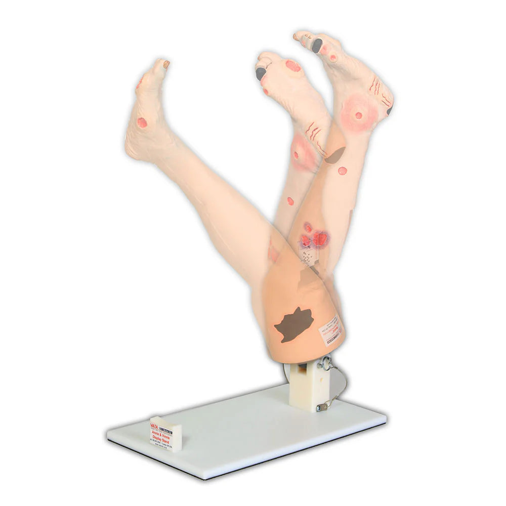 Display Stand for Vinnie or Annie Insufficiency Leg