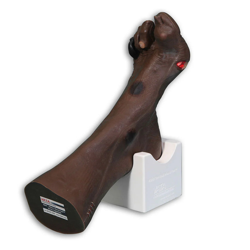 Wilma Wound Foot Trainer