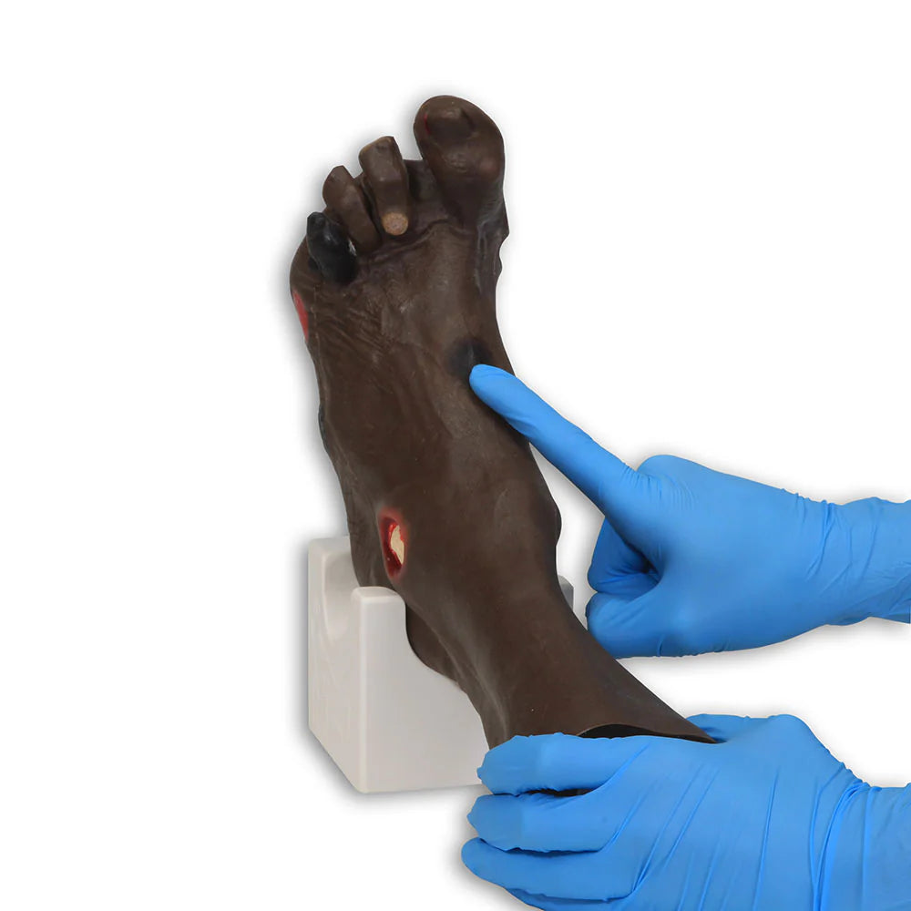 Wilma Wound Foot Trainer