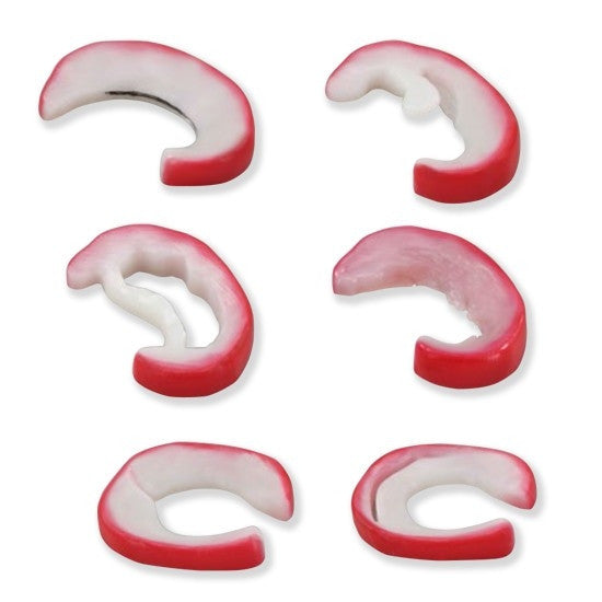 Knee Meniscus Tears Model