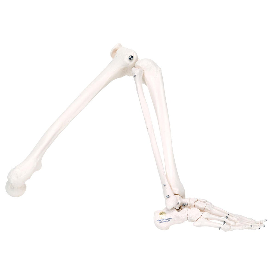A10 Stan Replacement Leg (Right)