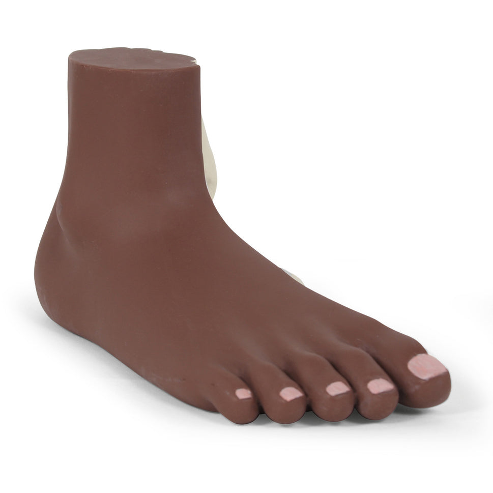 Flat Foot Model (Pes Planus)
