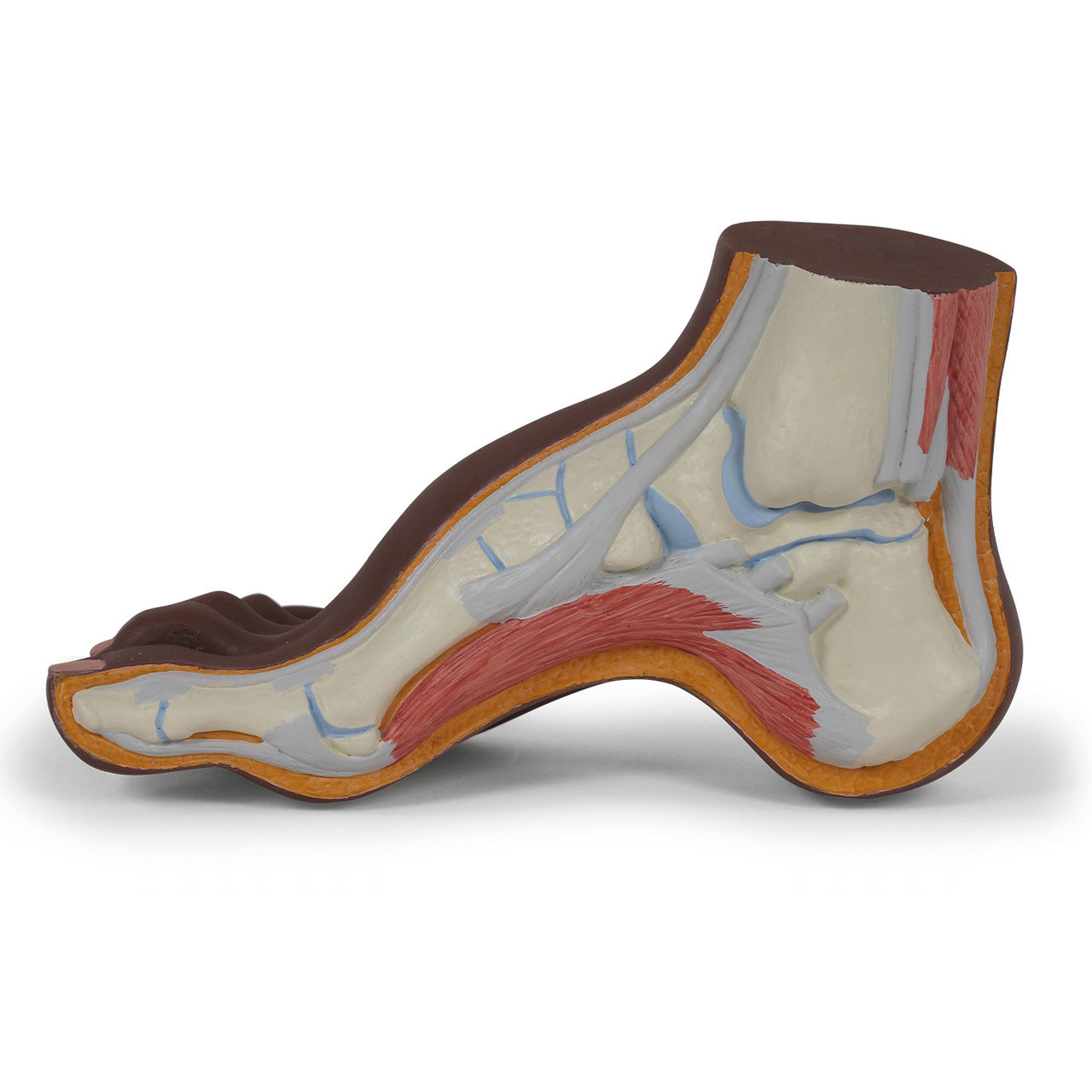 Hollow Foot Model (Pes Cavus)