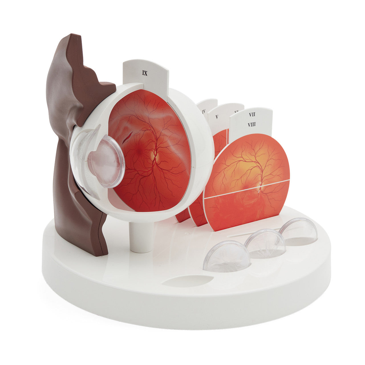 Pathological Eye Model