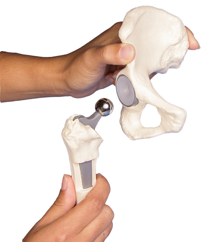 Hip Implant / Replacement Model Set (3 part)