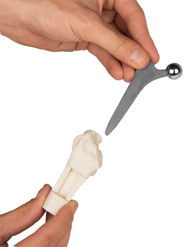 Hip Implant / Replacement Model Set (3 part)