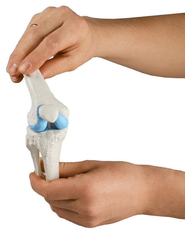Knee Implant / Replacement Model Set (3 part)