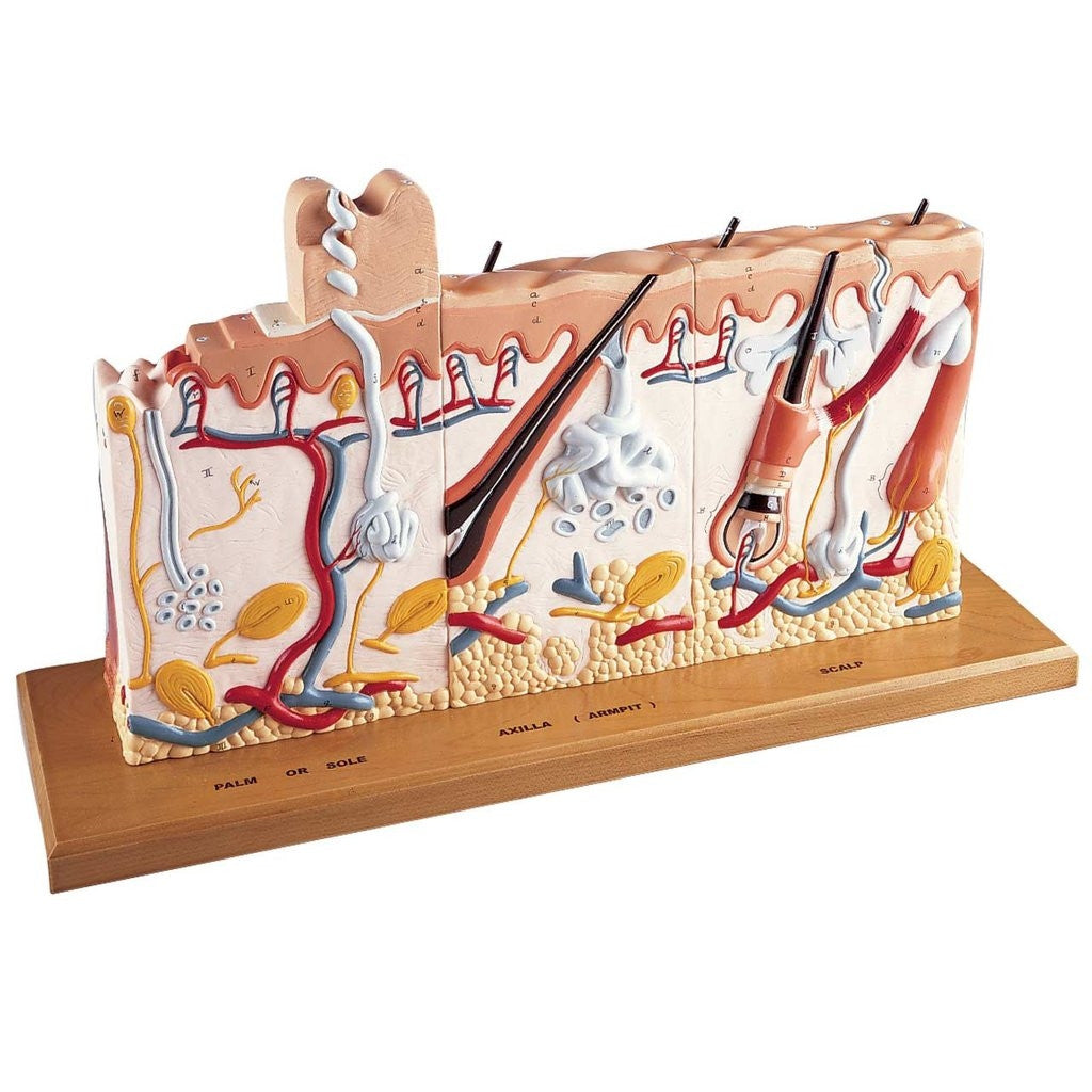 Human Skin Series with Burn Pathologies Model (75 times life size)