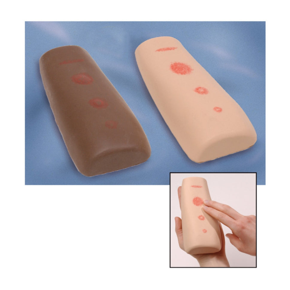 Palpable TB Training Arm Models