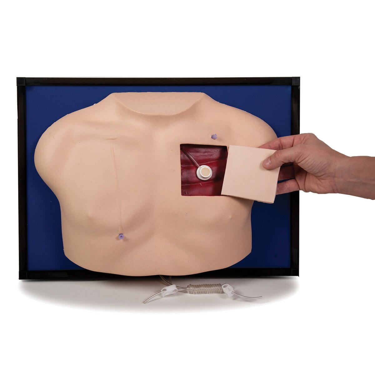 Venous-Access Device Model