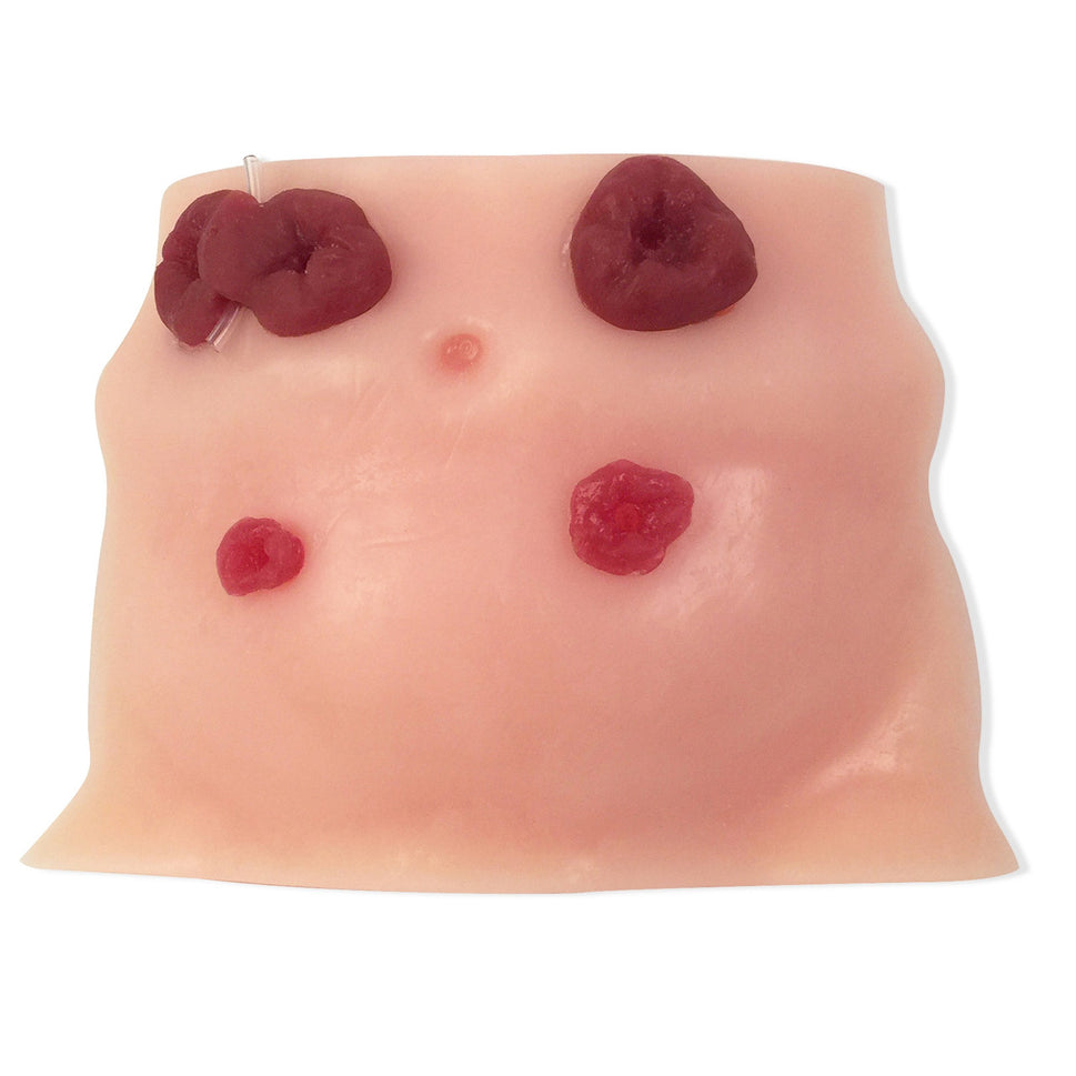 Ostomy Care Training Model