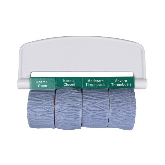 Vein Model with Thrombosis (4 part)