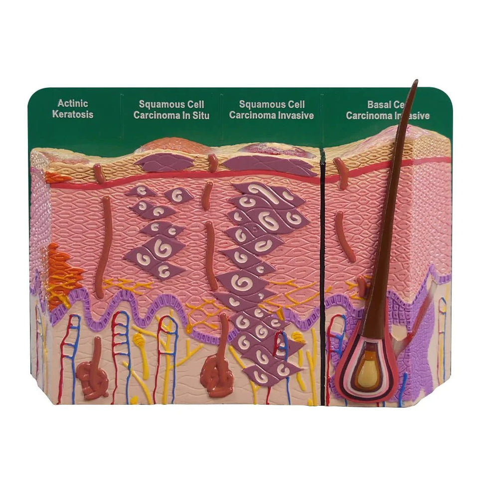 Skin Cancer Model (8 Skin Conditions)