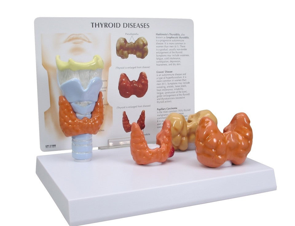 Thyroid Disease Model