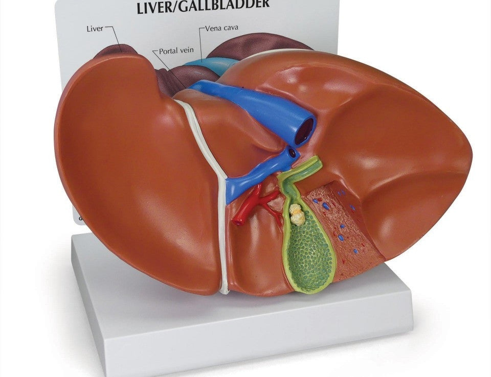 Liver and Gallbladder Model with Gallstones