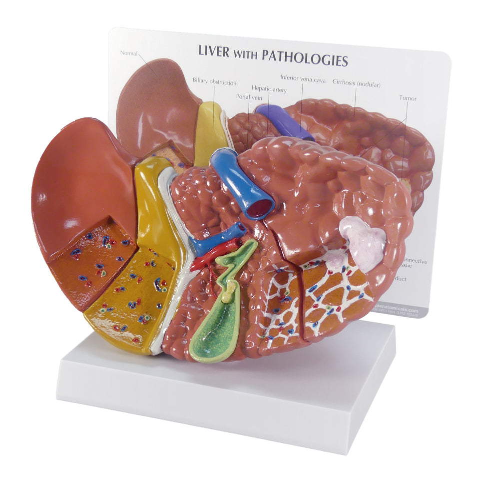 Liver Model with Pathologies
