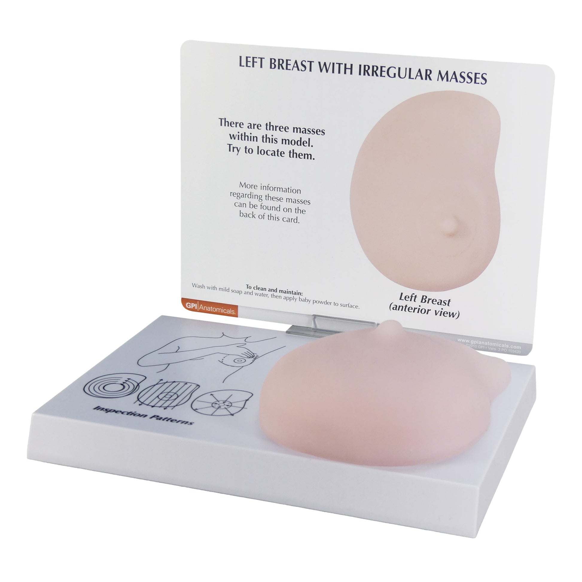 Breast Cancer Anatomical Model