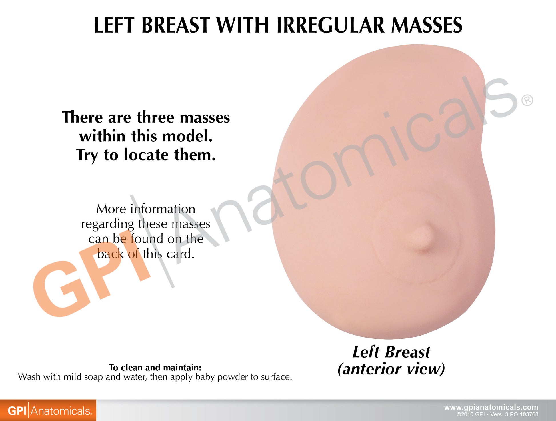 Breast Cancer Anatomical Model