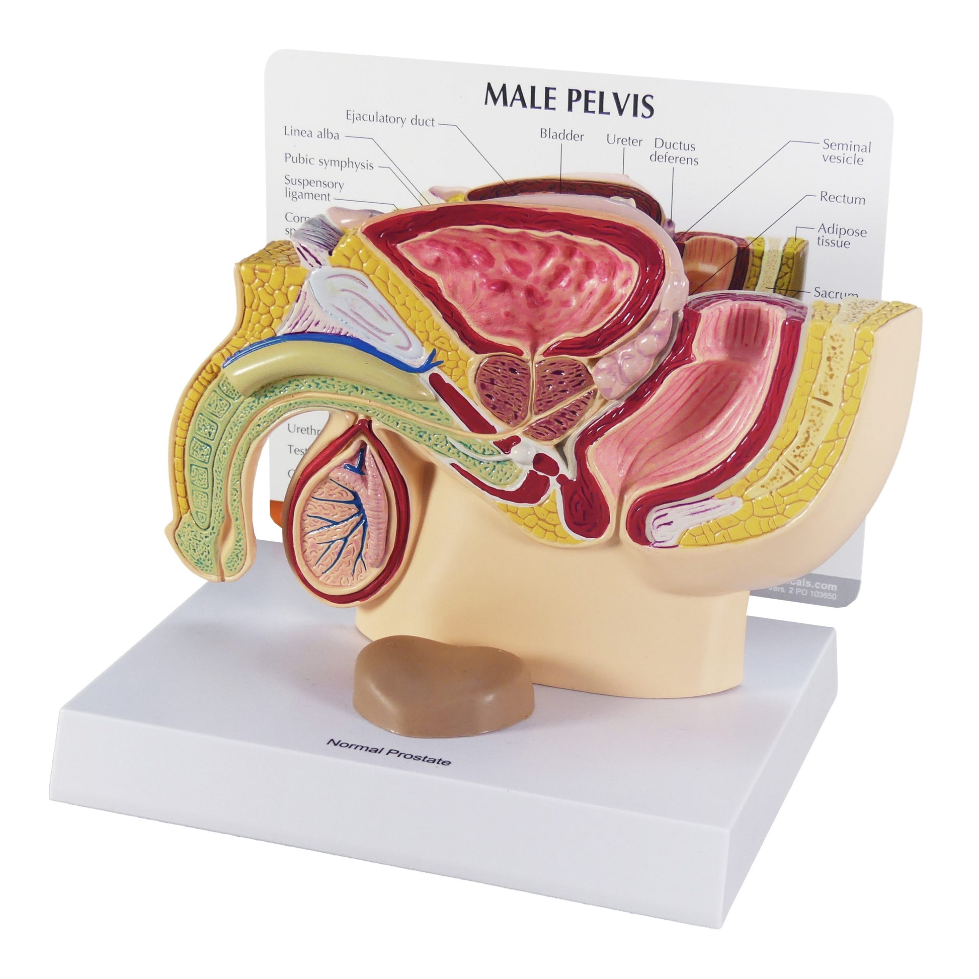Male Pelvis and Prostate Section Model