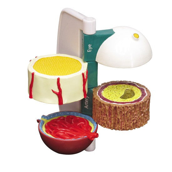 Diabetes Model (4 piece)