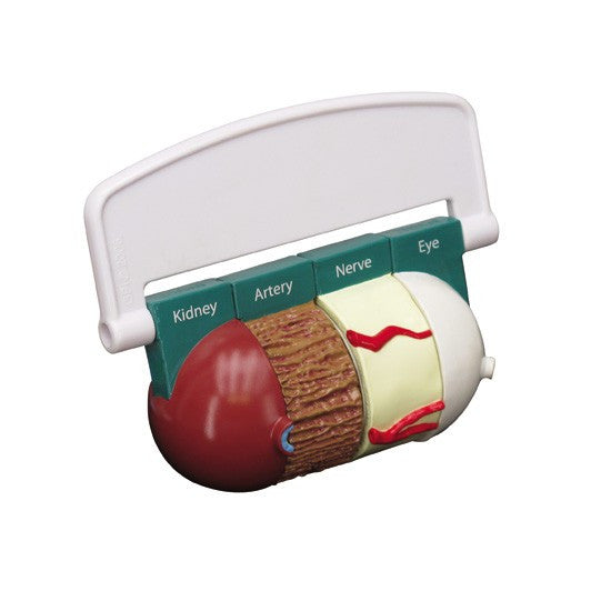 Diabetes Model (4 piece)