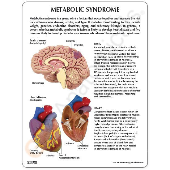 Metabolic Syndrome Model