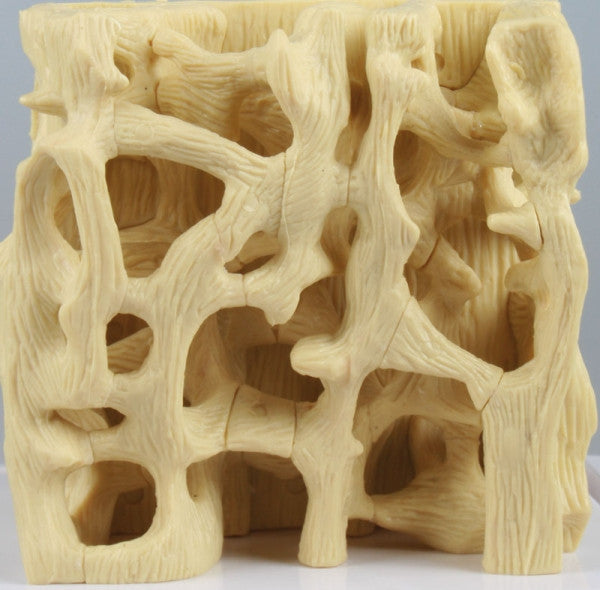 Healthy / Osteoporotic Bone Structure Model