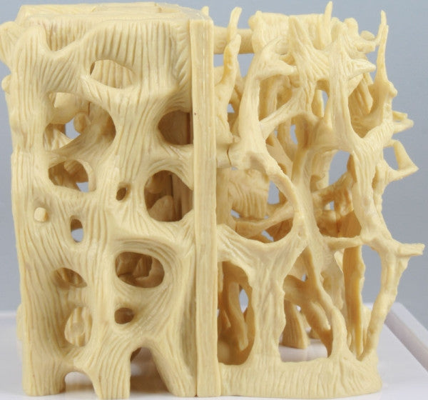 Healthy / Osteoporotic Bone Structure Model