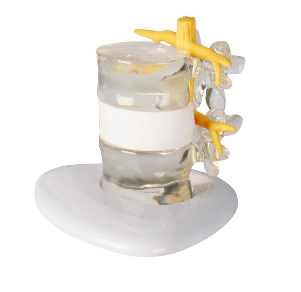Herniated Disc Simulator