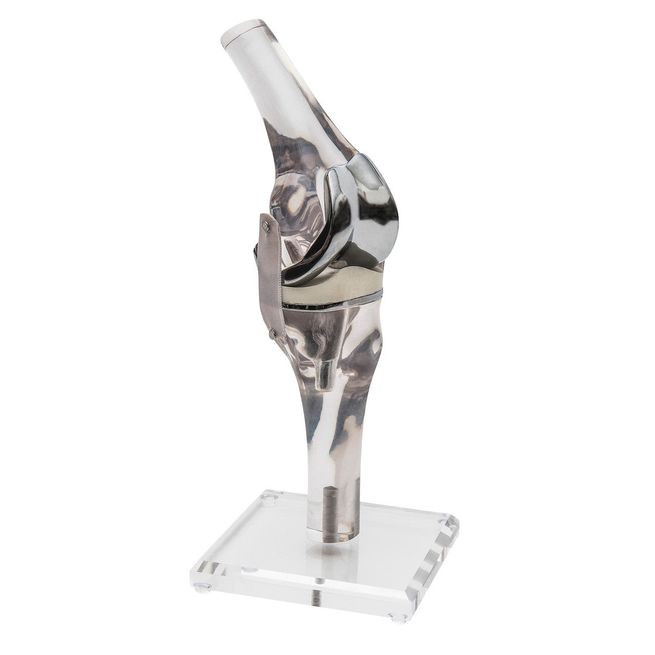 Knee Replacement Model (4449) Side