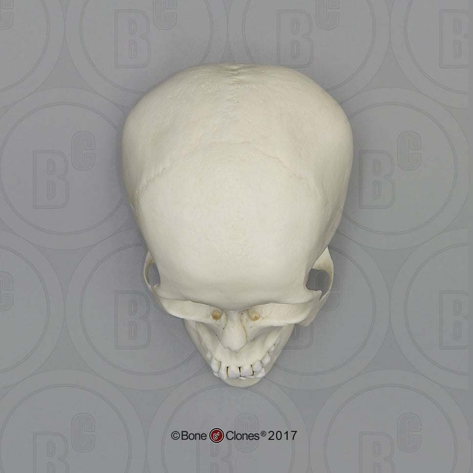 Adolescent Female Skull Model