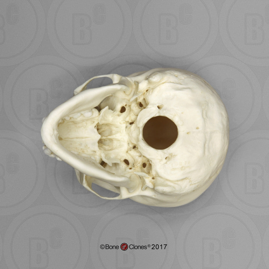 Adolescent Female Skull Model