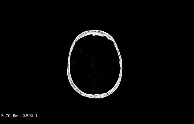 Adult Head Phantom (Standard) for X-Ray CT, US, MRI