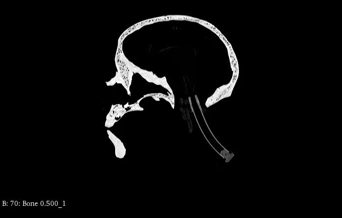 Adult Head Phantom (Standard) for X-Ray CT, US, MRI
