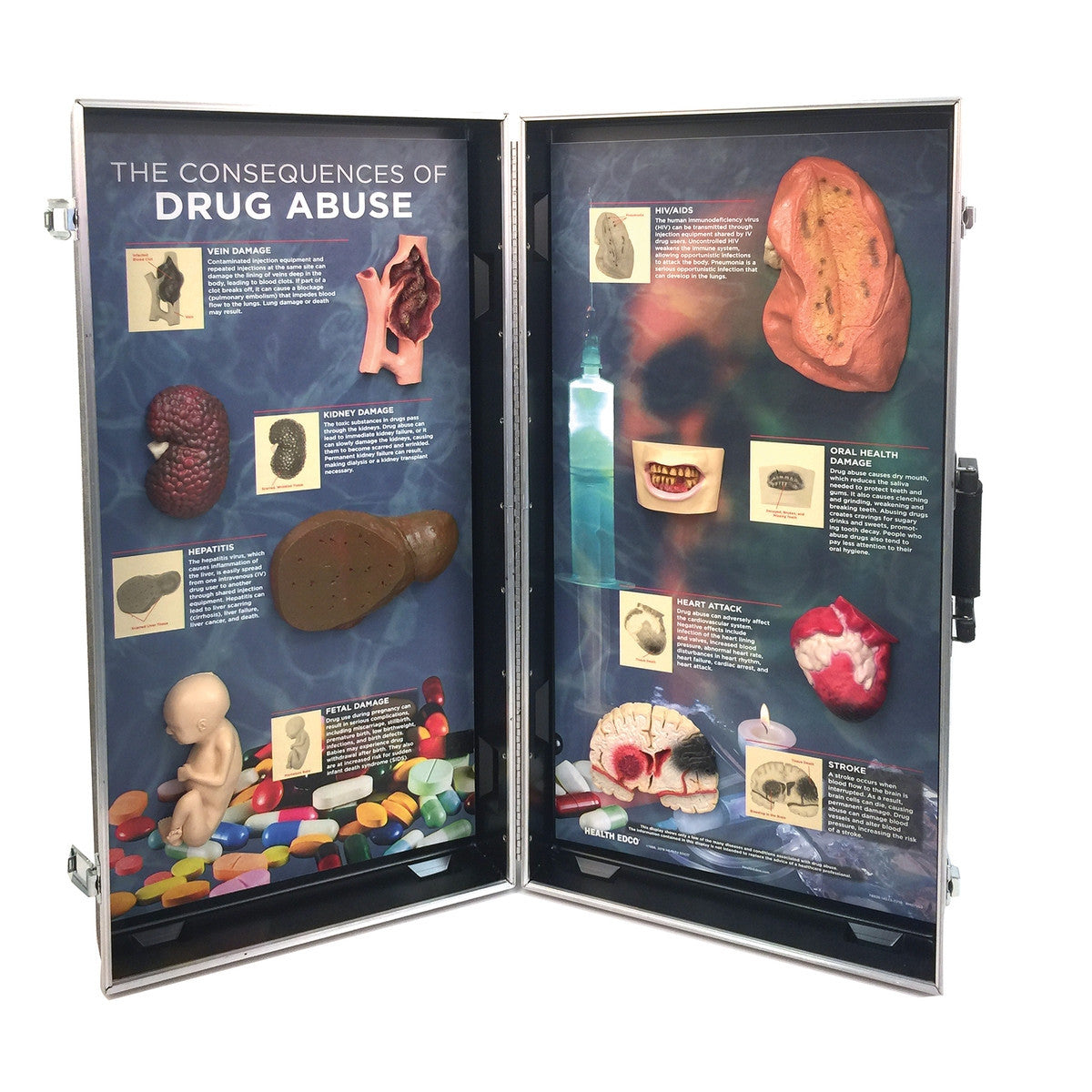 The Consequences of Drug Abuse 3D Display 1