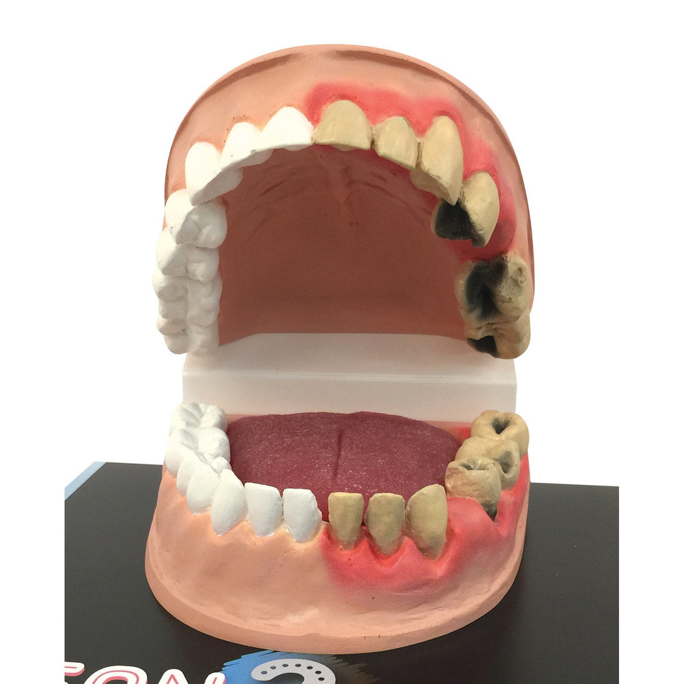 Clean Mouth / Dirty Mouth Display
