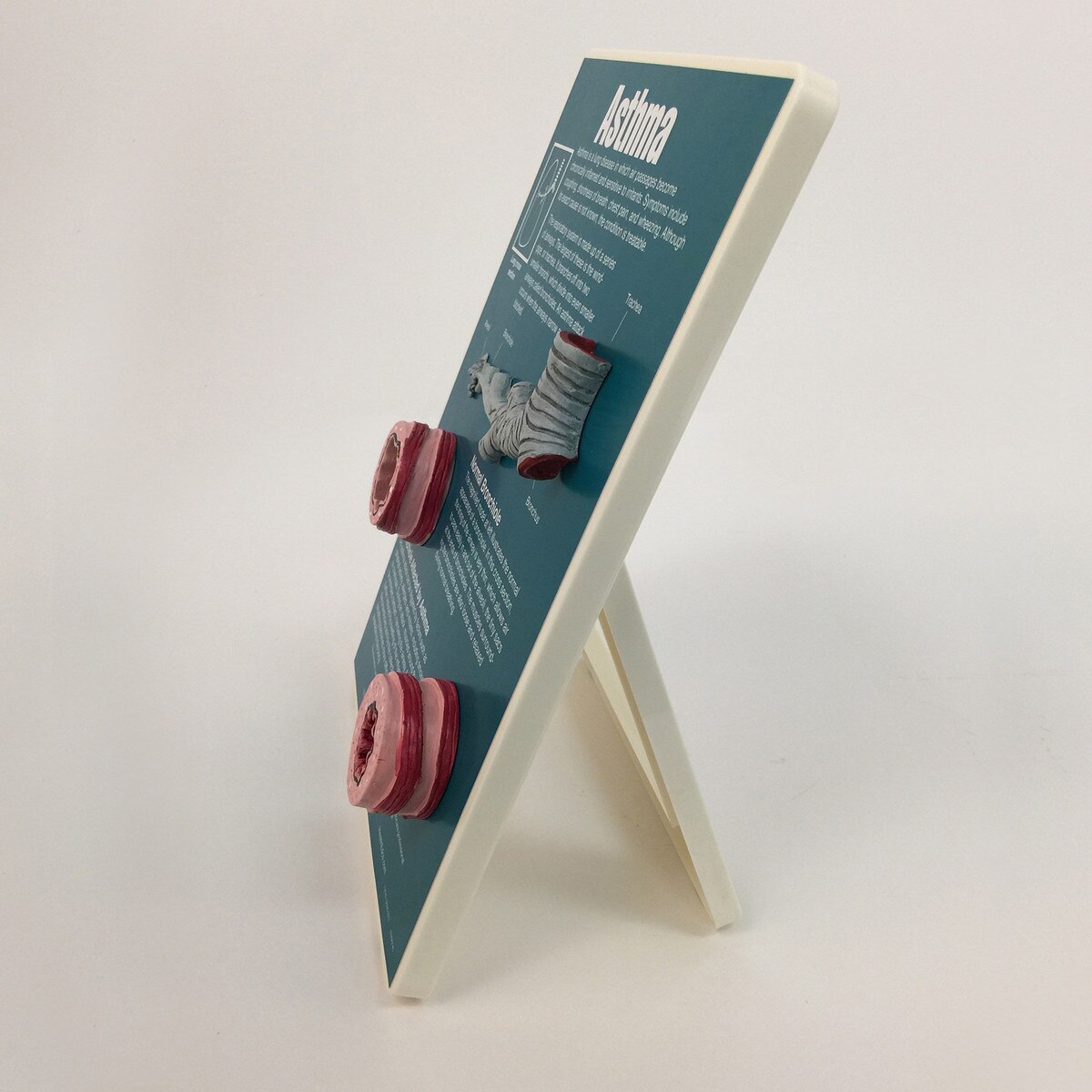 Asthma Easel Display