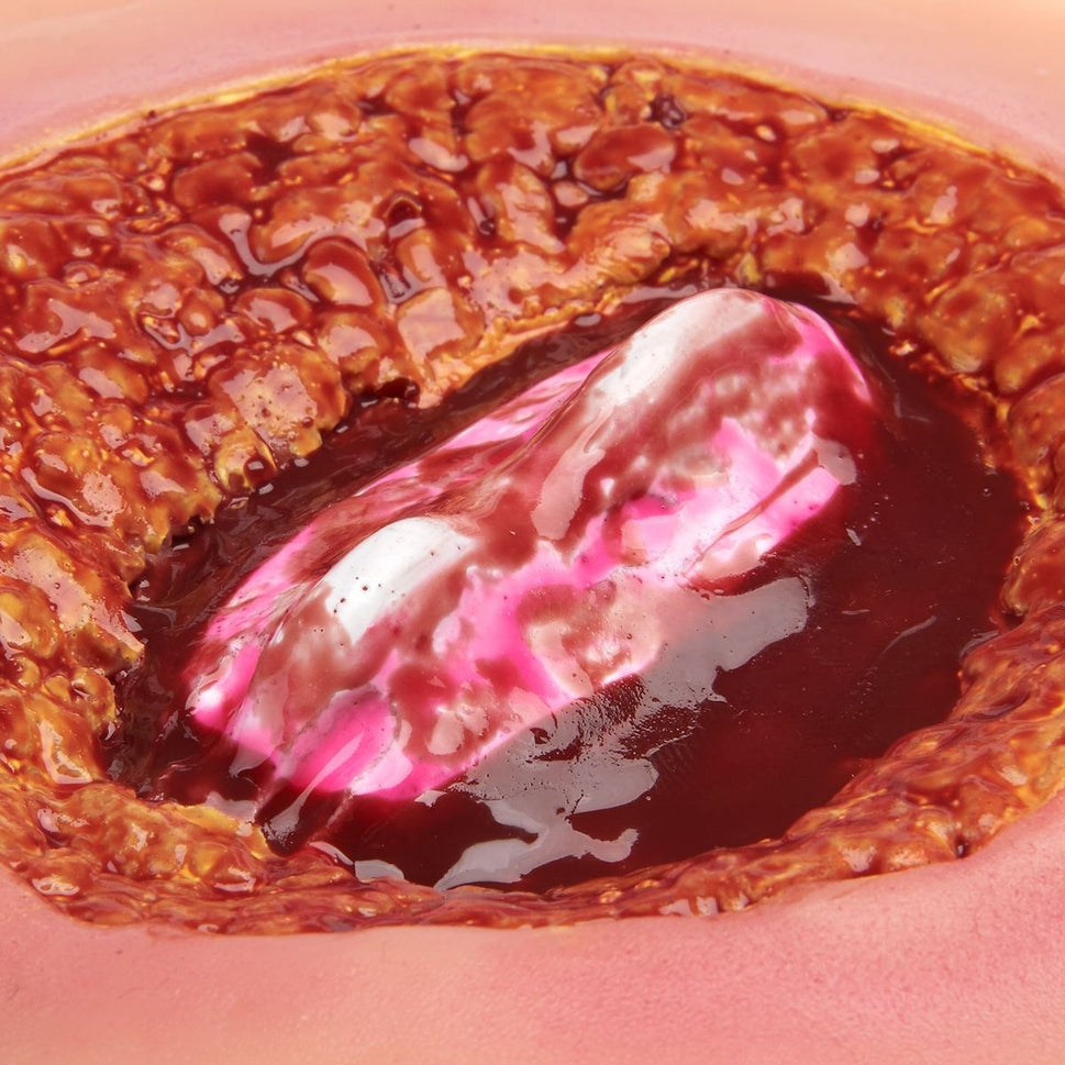 Nursing Care Wound Kit