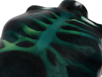 "Echo Eddie" Advanced Ultrasound & FAST Simulator