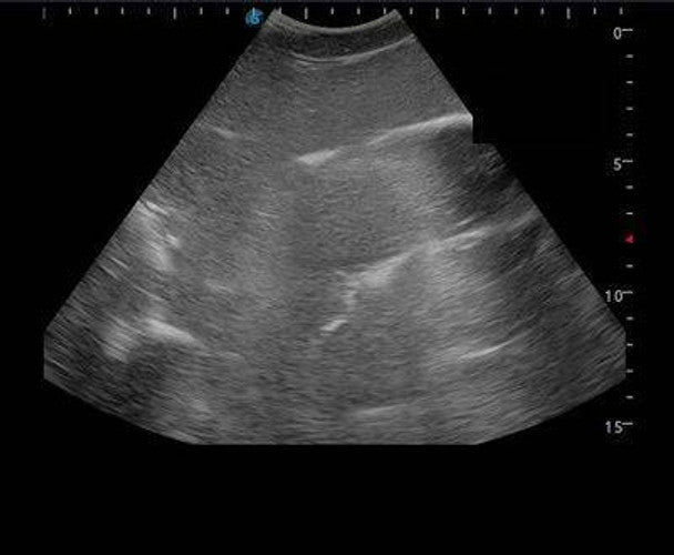 Femoral Arteriovenous Puncture and Abdominocentesis Ultrasound Training Model